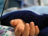 مرگ تلخ نوزاد ۱۳ ماهه پس از خطای پزشکی