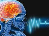 هفت عامل باورنکردنی سکته مغزی را بشناسید