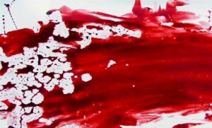 عکسی از خون روی زمین